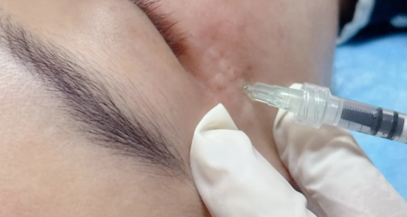 re2o膠原水光與普通水光在眼部應(yīng)用的核心區(qū)別