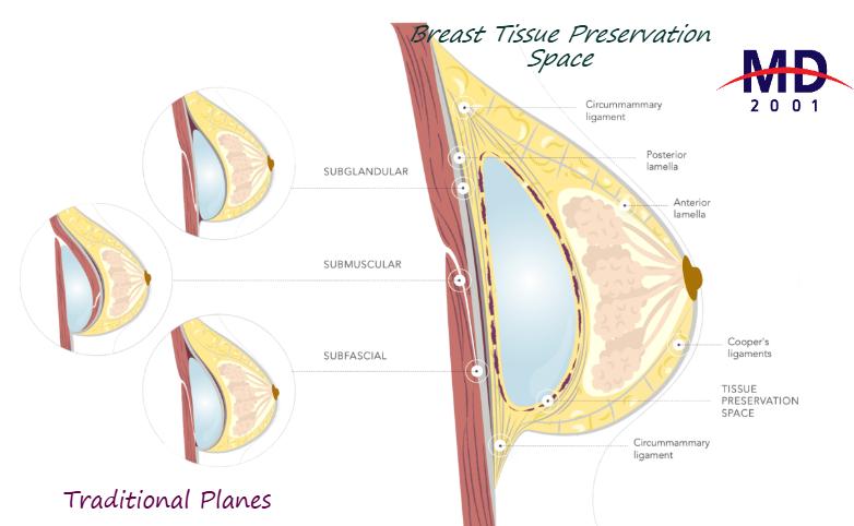 隆胸医生王威价格