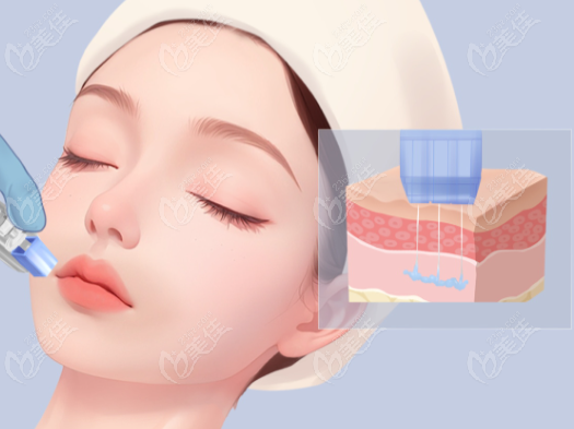 王贺林医生激光美容做的好 王贺林医生激光美容做的好