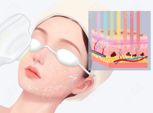 王贺林医生激光美容成效好 王贺林医生激光美容成效好