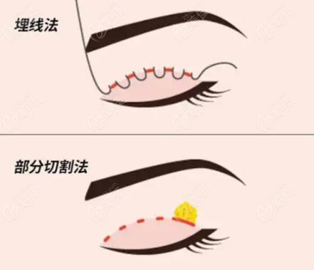 个性化服务与理念