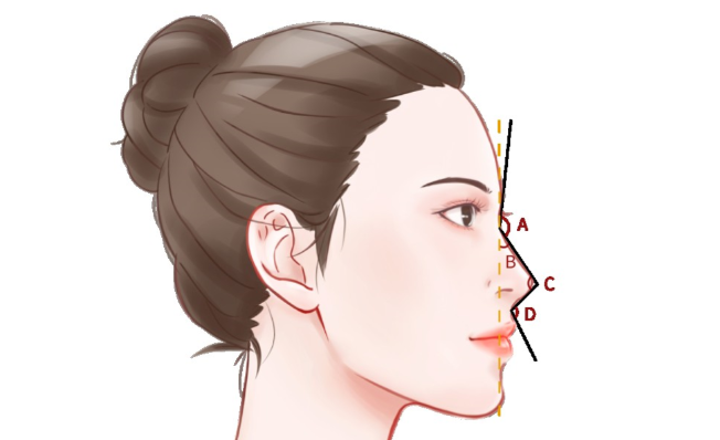 上海星璨梁亮鼻整形的真实实例参考